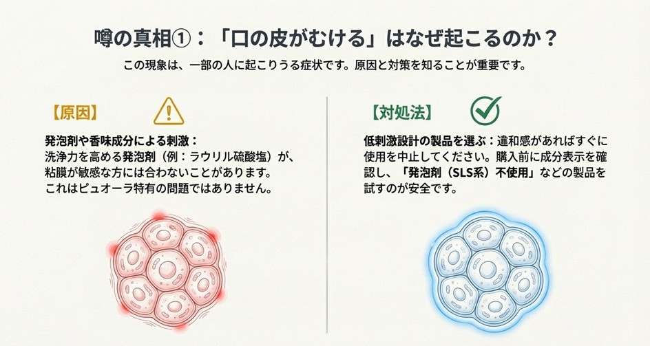 口腔内の粘膜細胞が刺激によって剥がれるメカニズムと、原因となる発泡剤（ラウリル硫酸塩）や低刺激製品への切り替え対処法の解説。